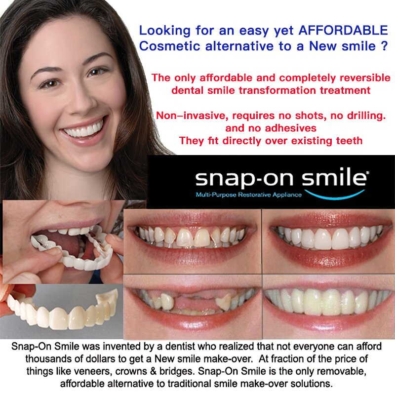 Adjustable Snapon Dentures